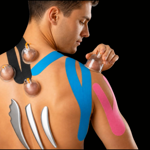Integrating Scraping, Cupping, and Kinesio Taping